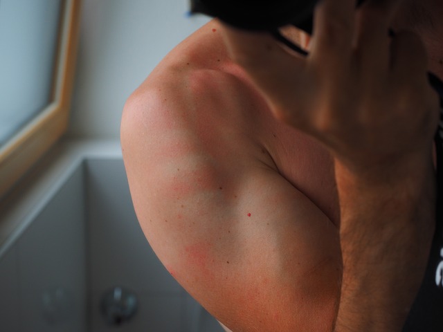 Skin Irritation or Redness (Skin Inflammation)